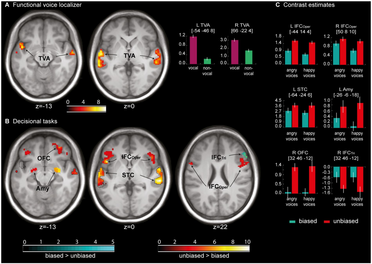 Biased and unbiased perceptual decision-making on vocal emotions